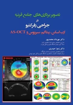 تصویربرداری های جامع قرنیه در جراحی رفرکتیو